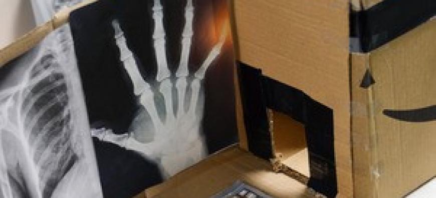 Portable X-Ray with Diagnostic Laptop and Cast/Bandage Creator